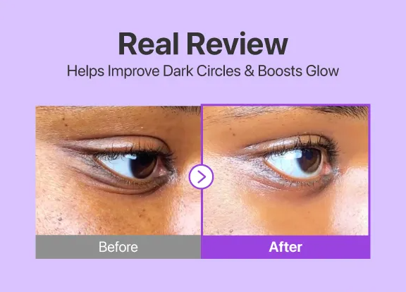 Numbuzin No.9 NAD+ Retinol Volumetox Eye Cream 10ml