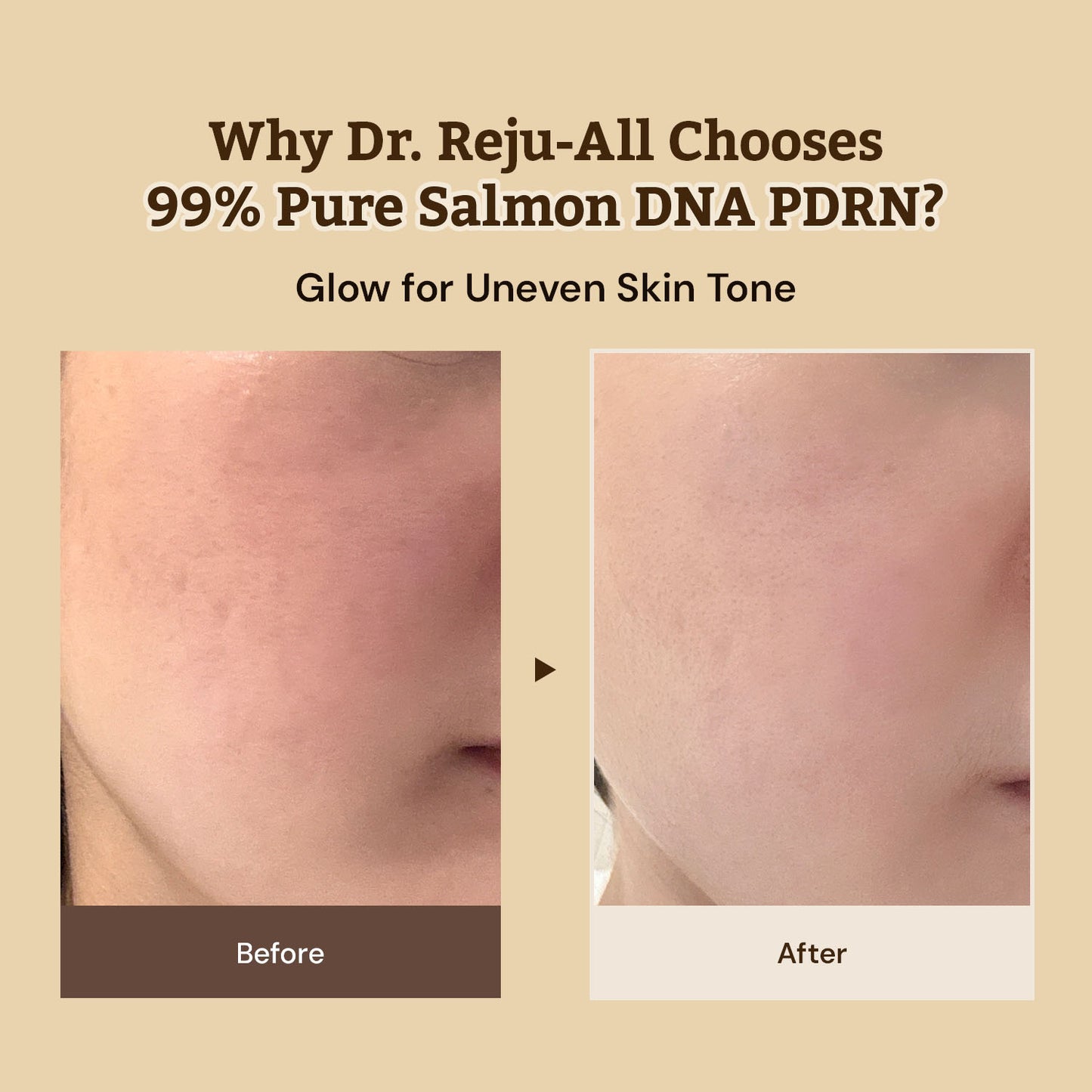 Dr. Reju-All Advanced PDRN Rejuvenating Cream 20ml